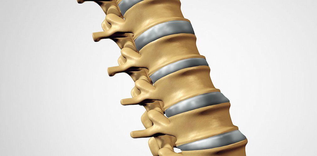 Artificial Disc Replacement Surgery
