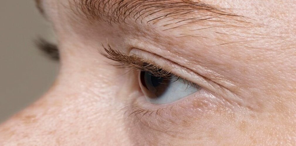 Diabetic Retinopathy
