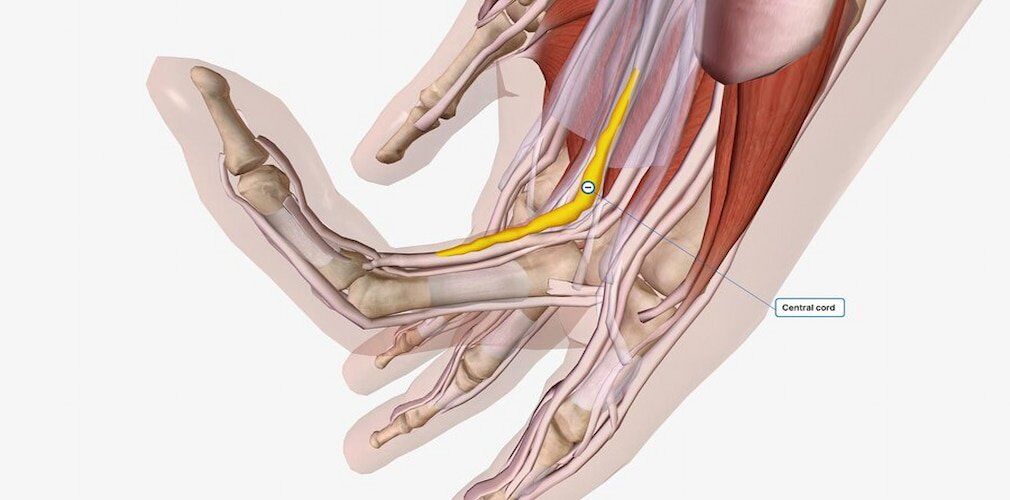 Dupuytren’s Contracture Surgery