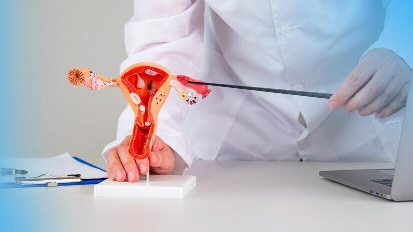 Ovarian Cysts Treatment