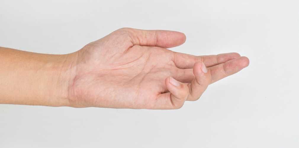 What are the treatment options for Dupuytren’s contracture?