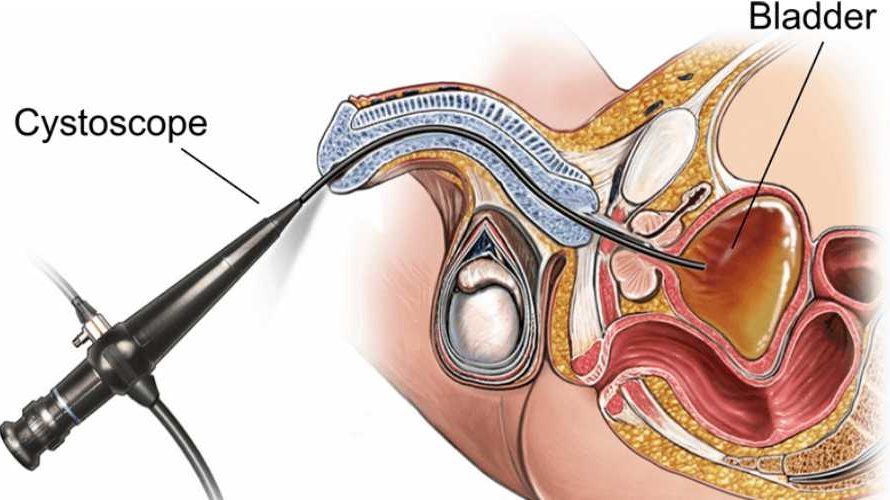 Urology