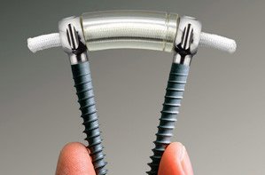 Dynamic (Flexible) Stabilisation