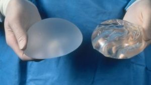 implants